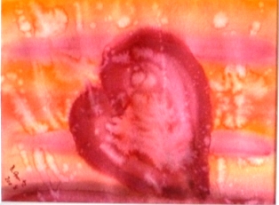 HerzDimension 314pix